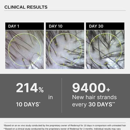 1X Bare Anatomy Advanced Hair Growth Serum 30 ml, X2Z1