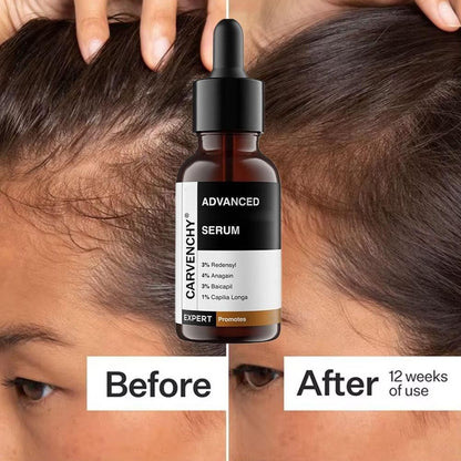 1X Bare Anatomy Advanced Hair Growth Serum 30 ml, X2Z1