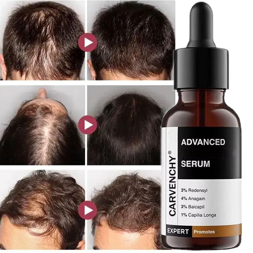 1X Bare Anatomy Advanced Hair Growth Serum 30 ml, X2Z1