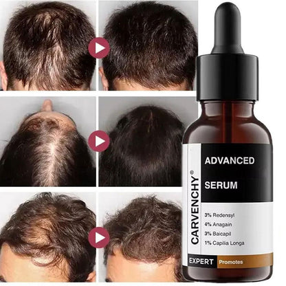 1X Bare Anatomy Advanced Hair Growth Serum 30 ml, X2Z1