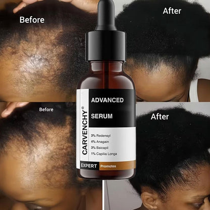 1X Bare Anatomy Advanced Hair Growth Serum 30 ml, X2Z1